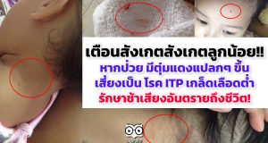 เตือนสังเกตสังเกตลูกน้อย!! หากป่วย มีตุ่มแดงแปลกๆ ขึ้น เสี่ยงเป็น โรค ITP เกล็ดเลือดต่ำ รักษาช้าเสี่ยงอันตรายถึงชีวิต!